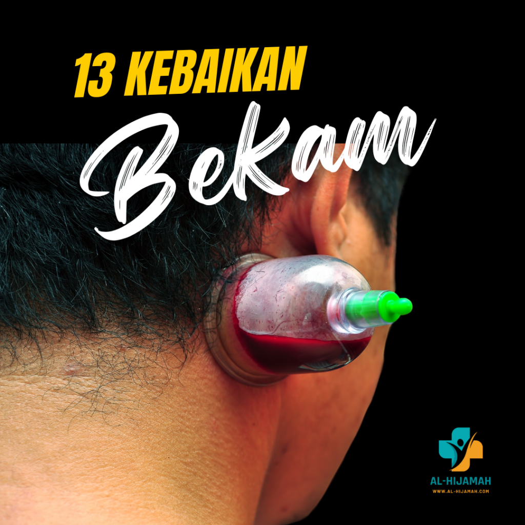 13 kelebihan bekam