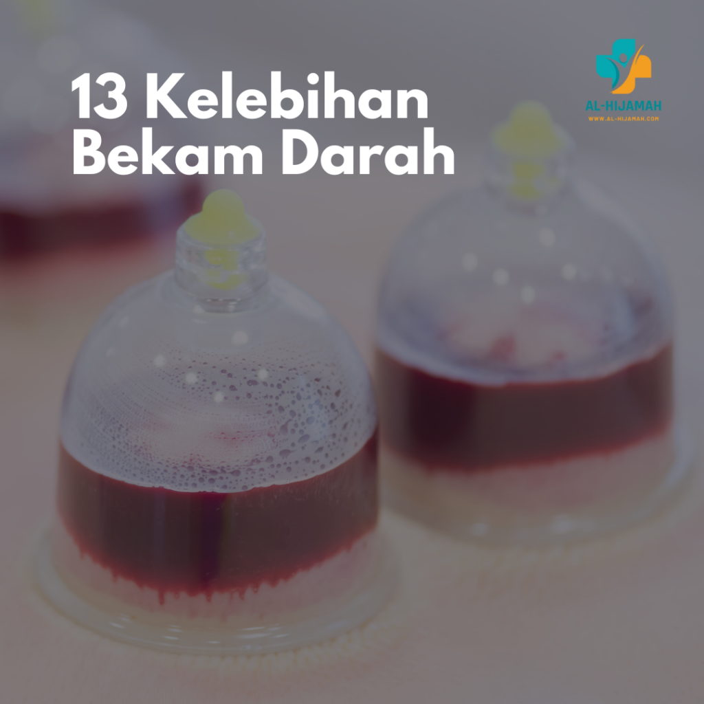 13 Kelebihan Bekam Darah