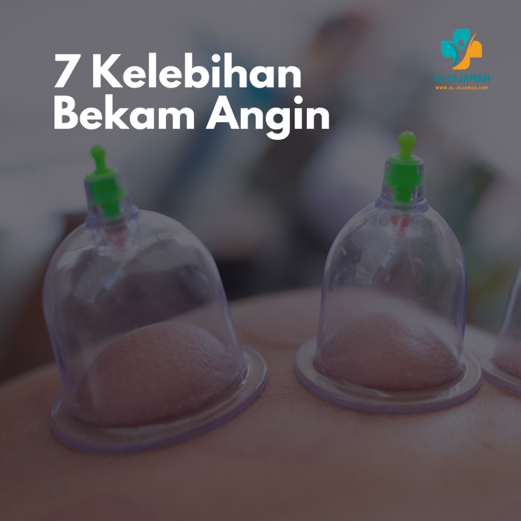 7 Kelebihan Bekam Angin