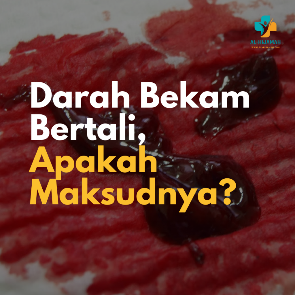 Darah Bekam Bertali