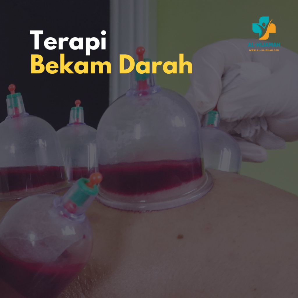 Terapi 
Bekam Darah